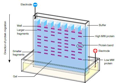 How to Read Protein Electrophoresis .